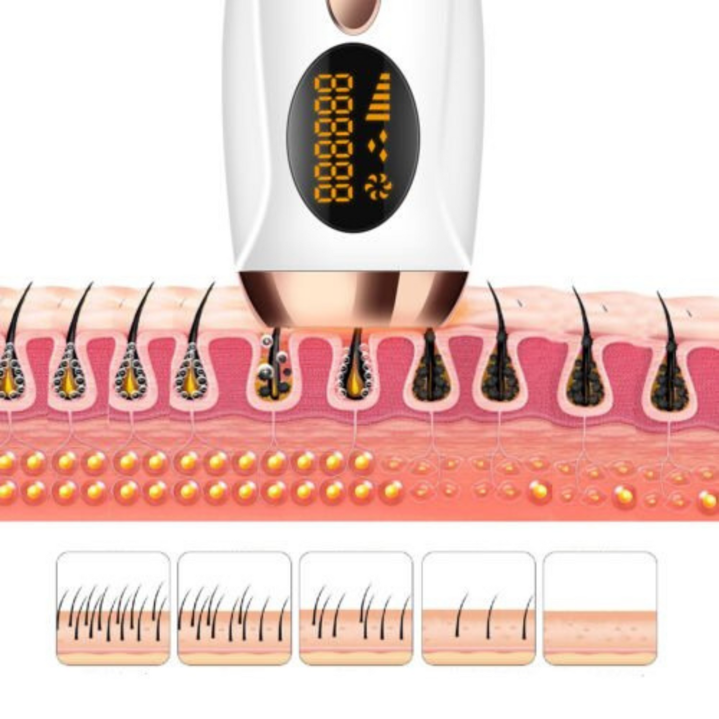 Permanent IPL Laser Hair Removal Epilator for Facial and Body