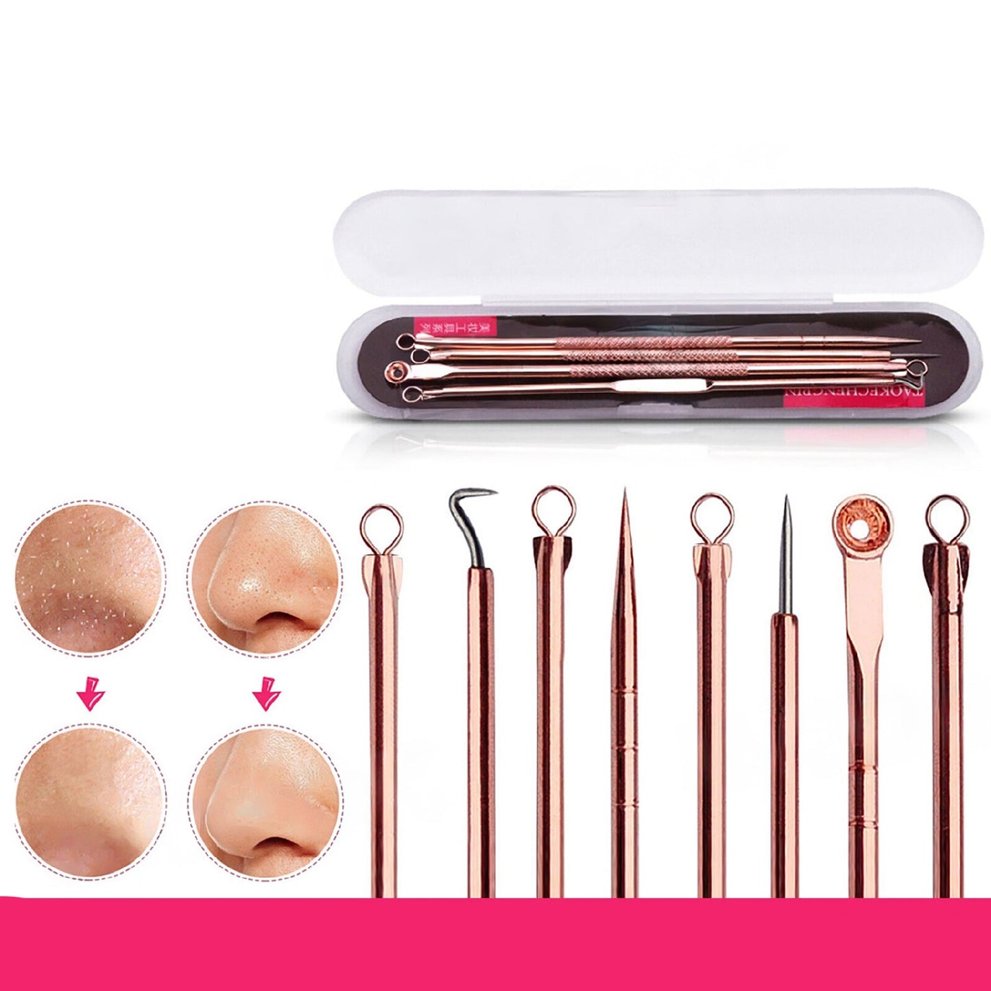 4pcs Blackhead Remover Tool Kit Pimple Popper Acne Blemish Comedone Cleaner