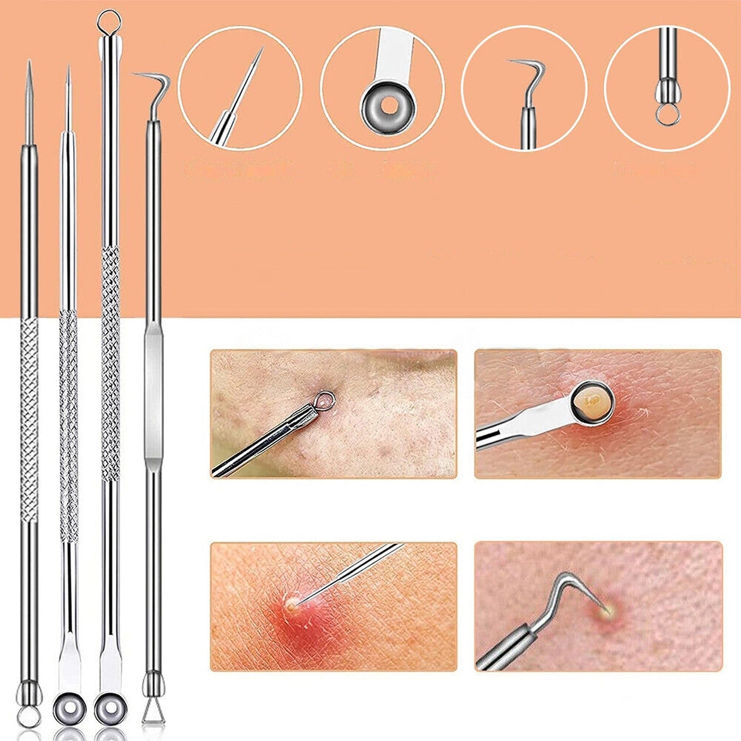 9pcs Comedone Extractor Tool Kit Blackhead Pimple Spot Remover