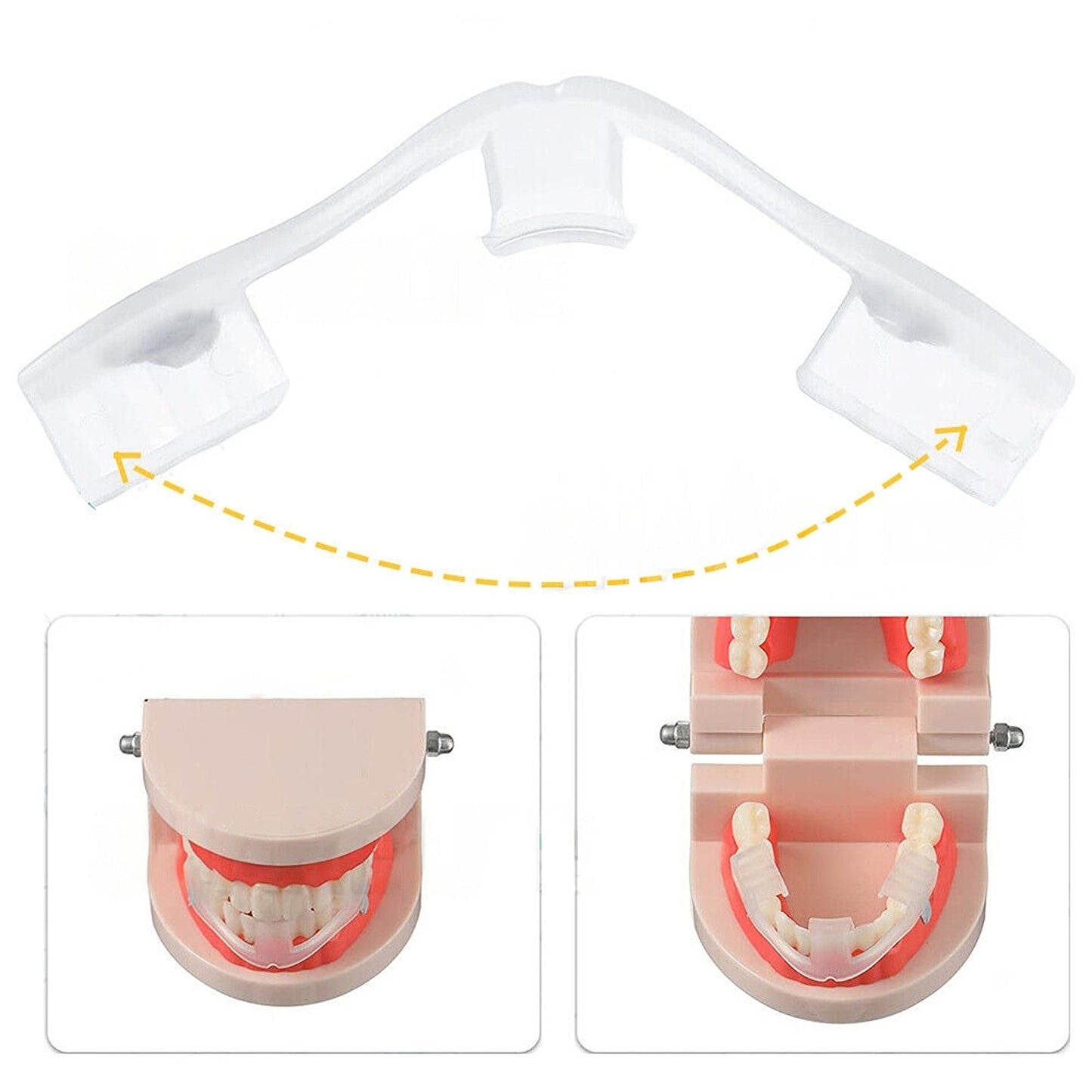 Dental Night Guard for Bruxism Protective Teeth Grinding Shield