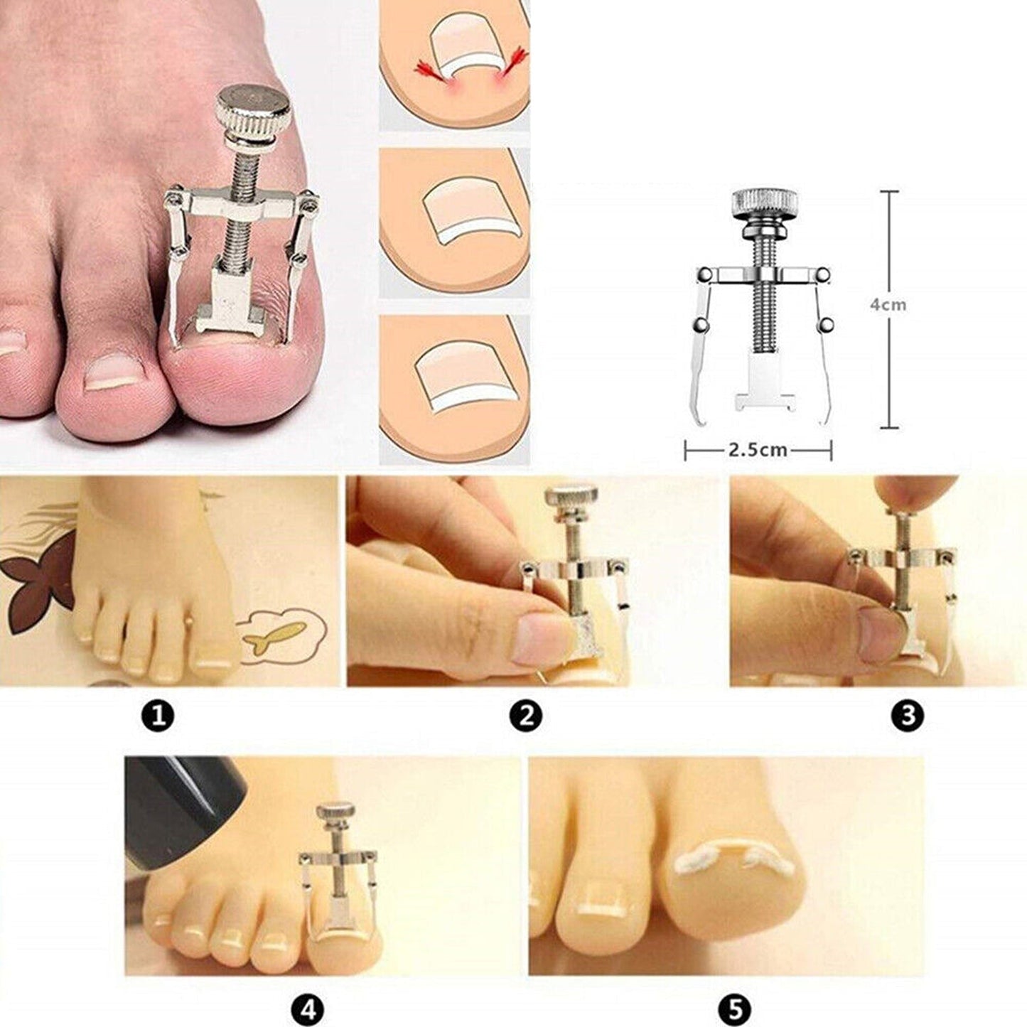 12pcs Ingrown Toenail Treatment Kit with Nail Clippers and Pedicure Tools