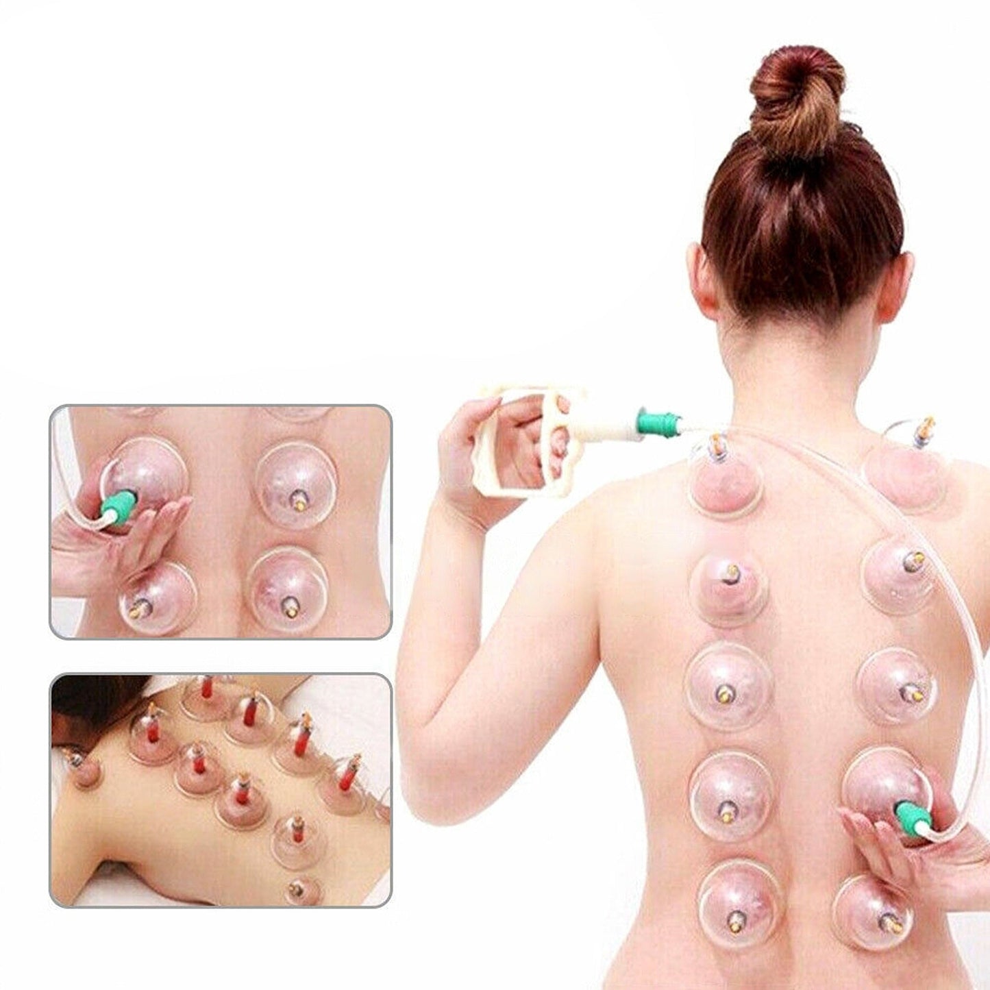 Cupping Therapy Set for Massage and Suction Treatment 32 Cups