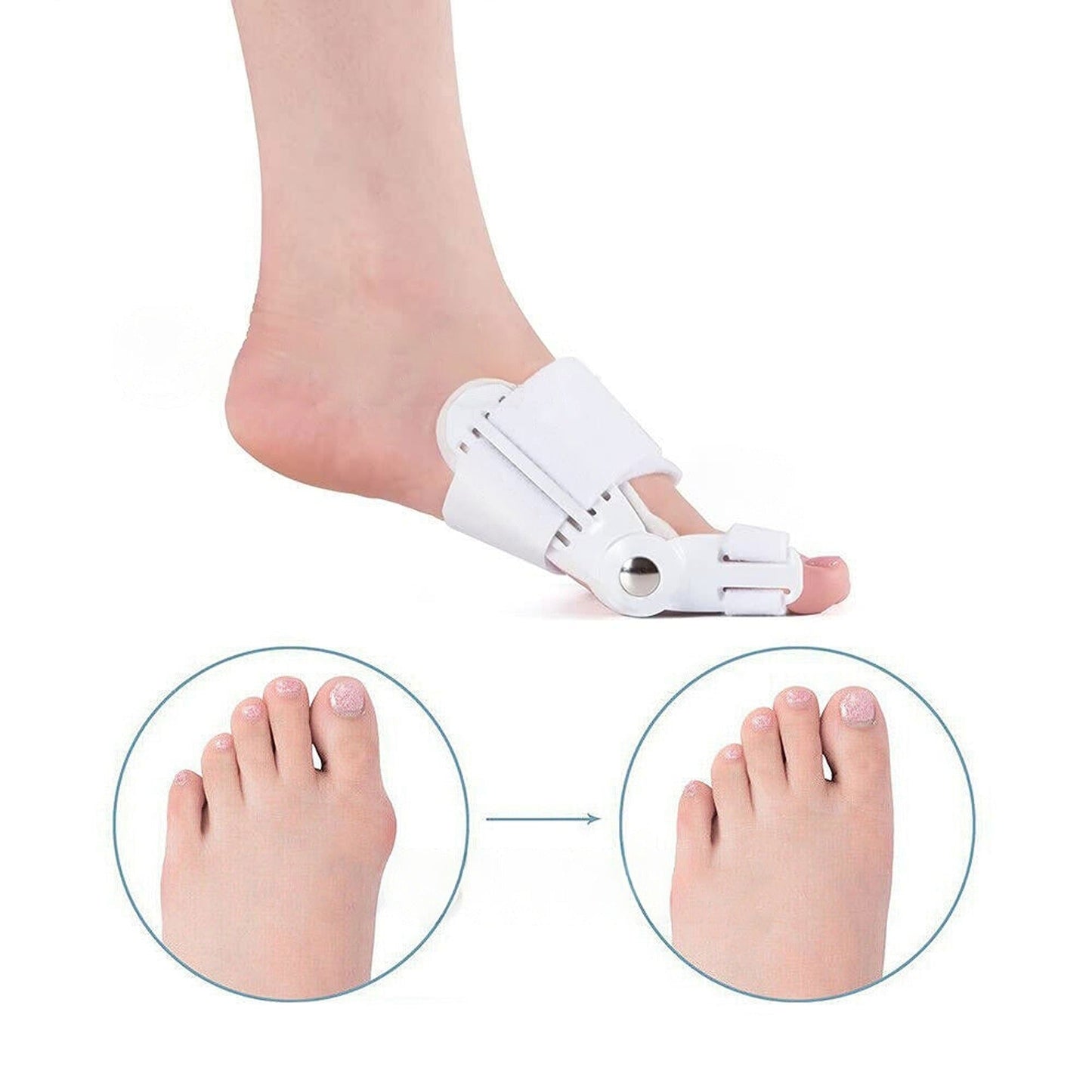 2pcs Big Toe Bunion Corrector Hallux Valgus Foot Splint Straightener