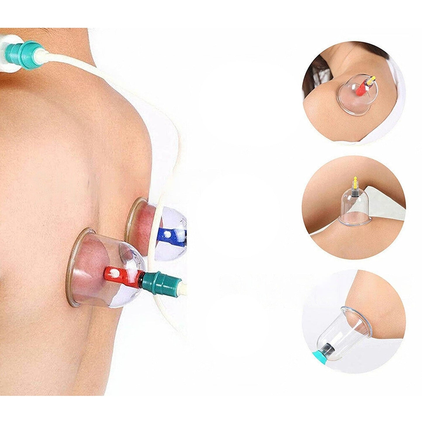 Cupping Therapy Set for Massage and Suction Treatment 32 Cups