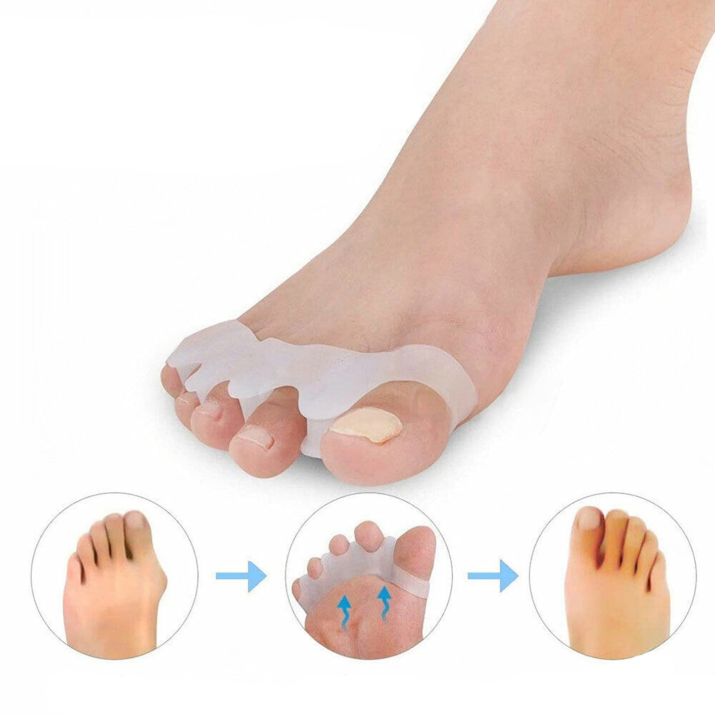 Gel Toe Separator for Bunions Silicone Corrector Hallux Straightener