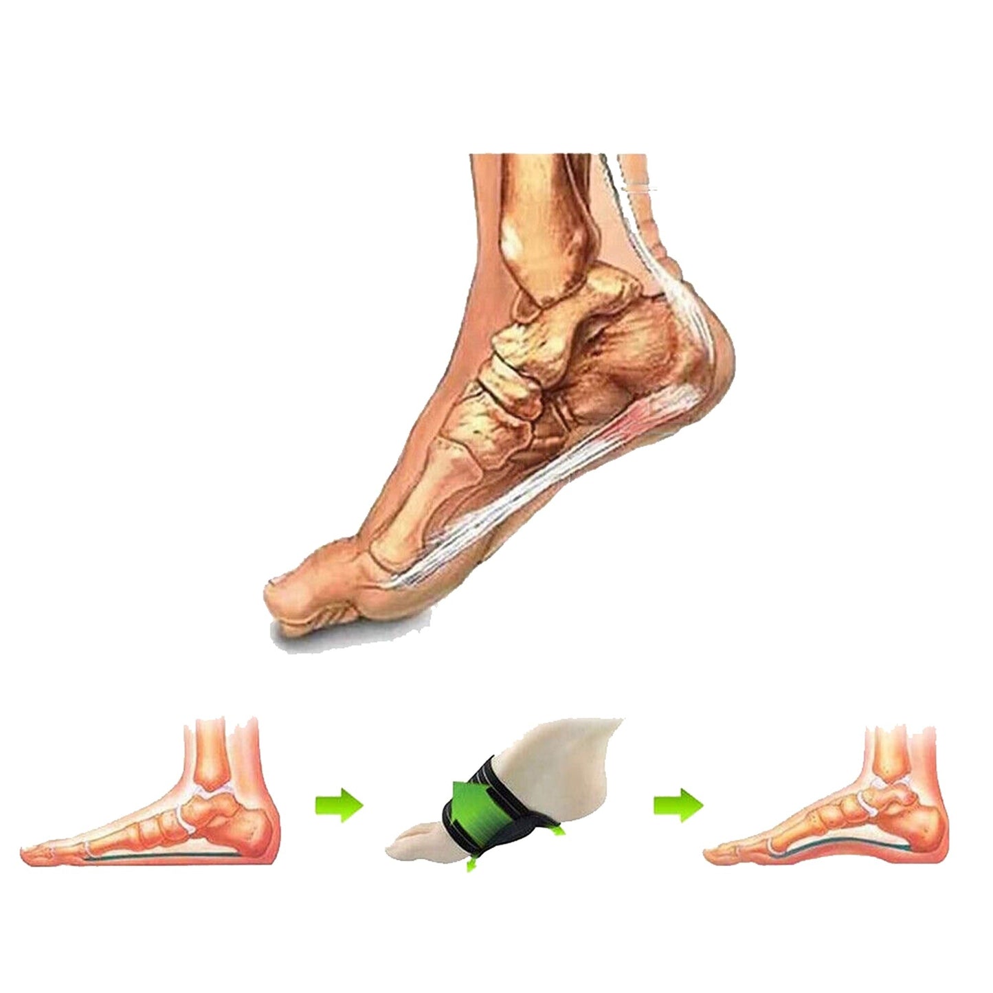 3Pair Arch Support Insoles for Flat Feet Plantar Fasciitis Foot Cushion