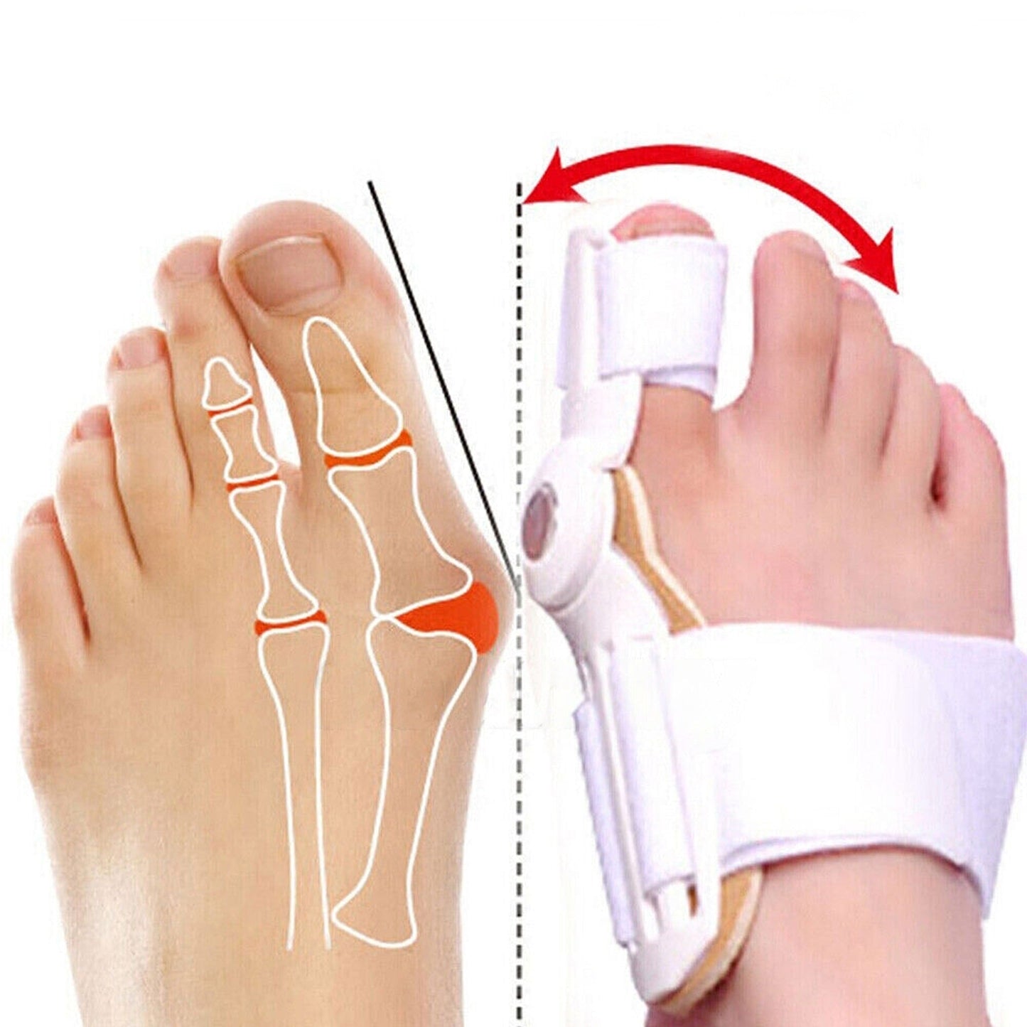 2pcs Big Toe Bunion Corrector Hallux Valgus Foot Splint Straightener