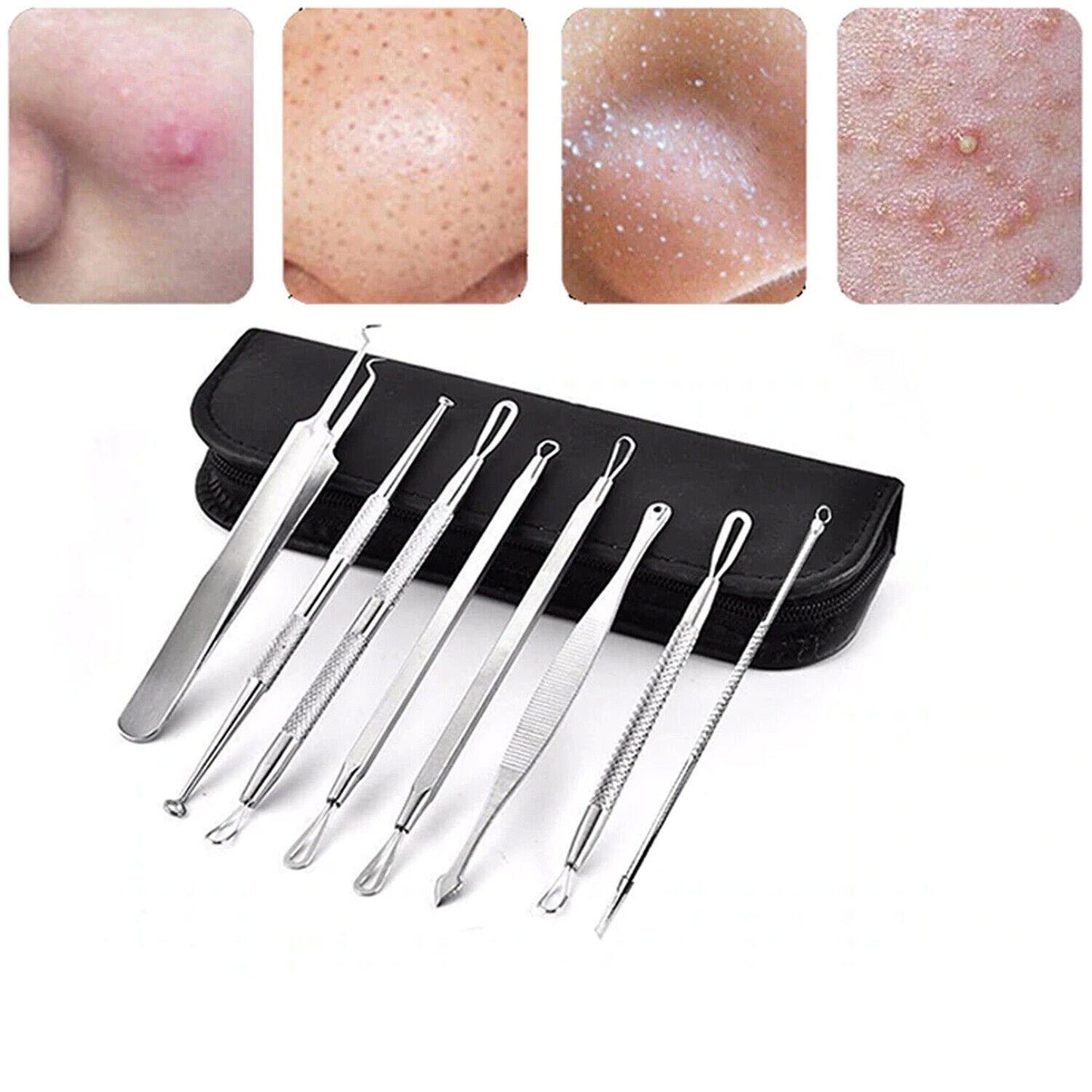 8-Piece Blackhead and Pimple Extractor Tool Set for Acne Treatment