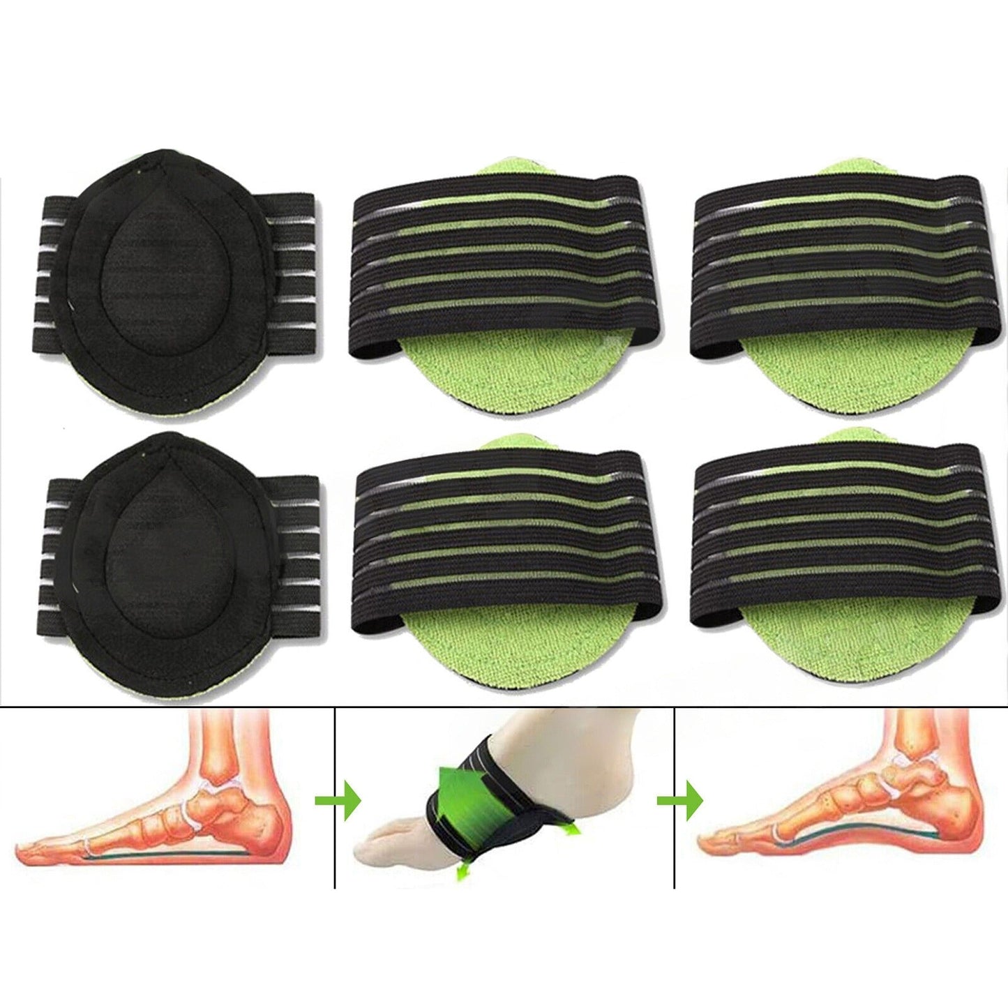 3Pair Foot Arch Support Plantar Insoles Shoe Insert Pads