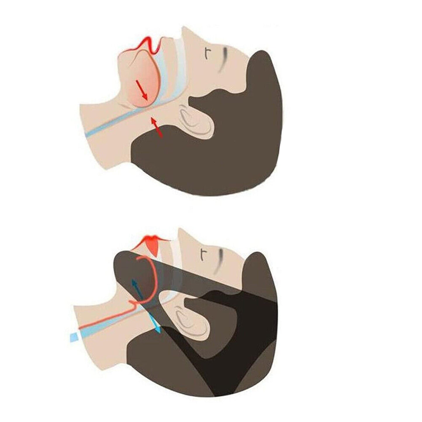 Sleep Support Jaw Belt Anti Snore Chin Strap Apnea Device