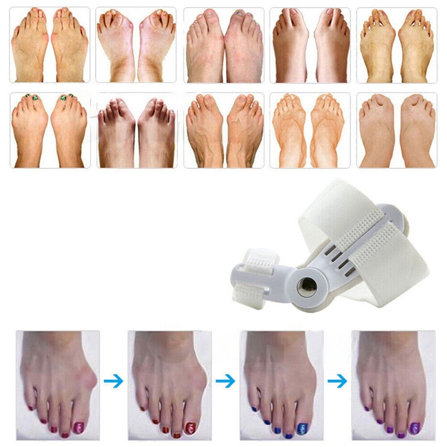 2pcs Big Toe Bunion Corrector Hallux Valgus Foot Splint Straightener