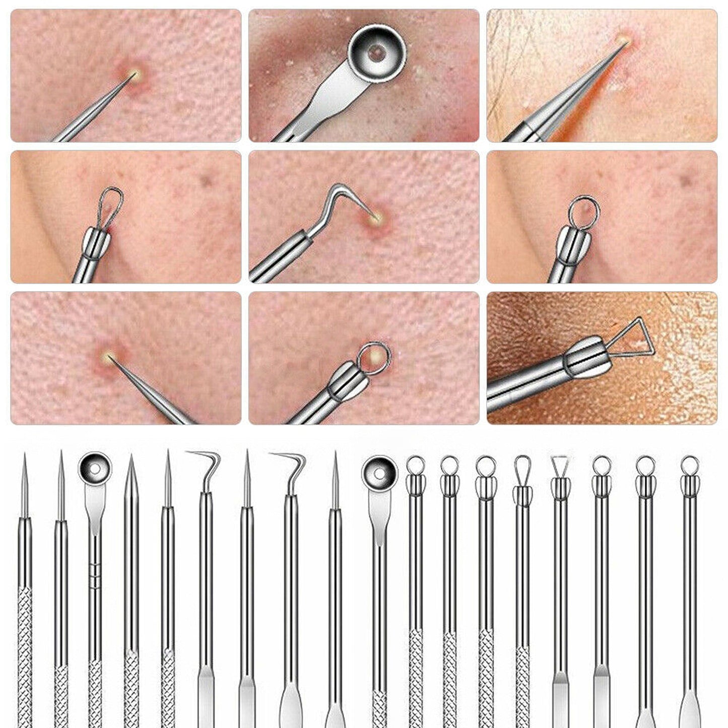 9pcs Comedone Extractor Tool Kit Blackhead Pimple Spot Remover