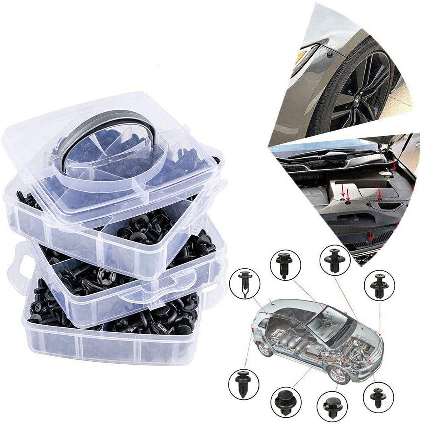 Car Body Fastener Retainer Clips Kit Universal Plastic Auto Trim Clips 1586 Pieces
