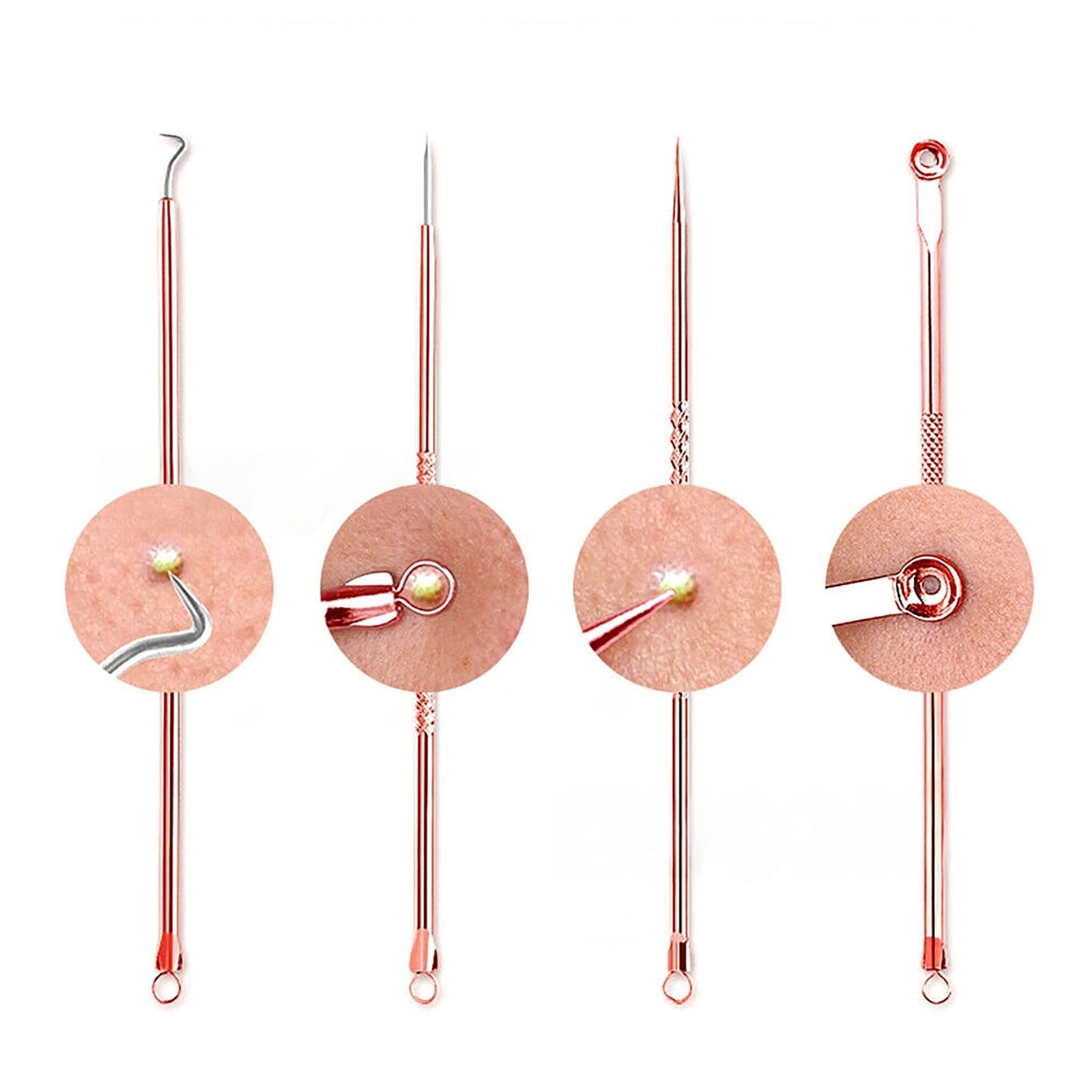 4pcs Blackhead Remover Tool Kit Pimple Popper Acne Blemish Comedone Cleaner